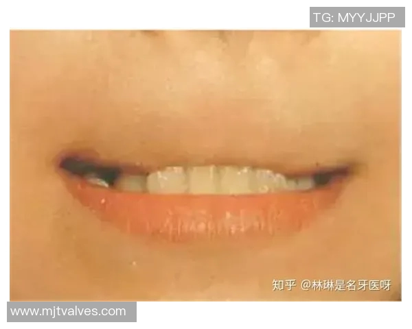 足球场上的咬人事件揭秘牙齿锋利的明星球员背后的故事